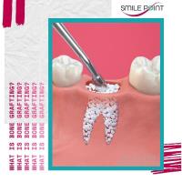 Smile Point Dental image 5